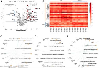 Iron metabolism-related genes reveal predictive value of acute coronary syndrome